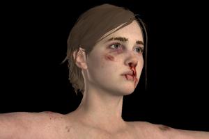 Ellie Injured Ellie Injured-3